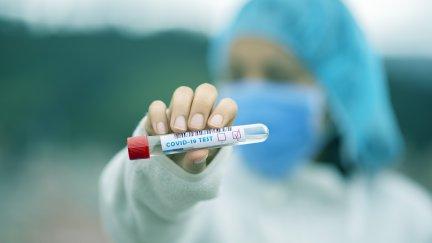 Fotografía coronavirus