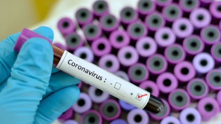 Test de Coronavirus