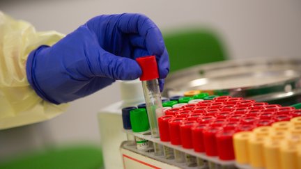 Profesional sanitario coloca muestras para un cribado de COVID-19