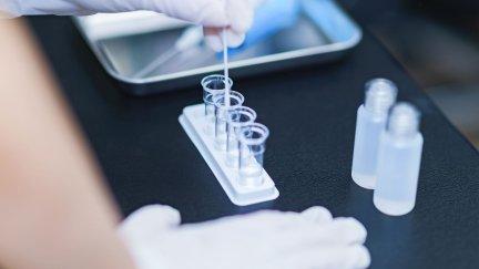 Muestra PCR.