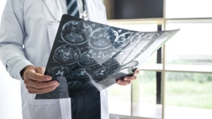 Radiografía neurológica.