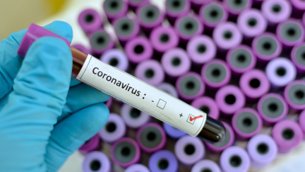 Una muestra positiva de COVID-19.