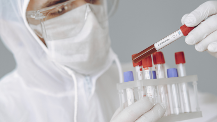 Un sanitario analiza muestras COVID-19.