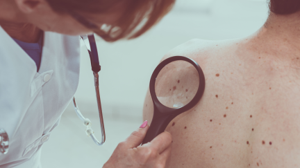 Un médico evalúa las manchas de piel de un paciente.
