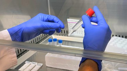 Esta semana ha habido hasta tres días por debajo de los cien contagios comunicados en Aragón.