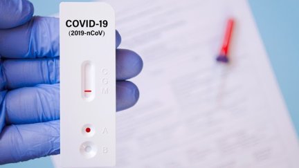 Imagen de un test de autodiagnóstico de la COVID-19 (EP).