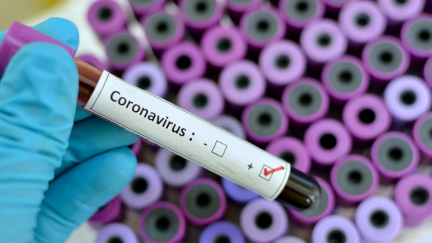 Muestra positiva de COVID-19.