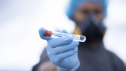 Un sanitario sostiene una muestra de COVID-19.