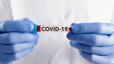 Muestra de COVID-19.