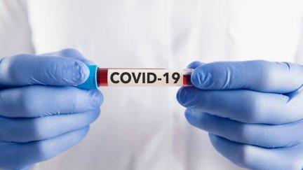Un sanitario muestra una muestra de posible COVID-19.