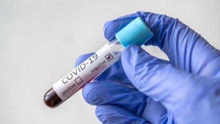 Una muestra PCR COVID-19. / EP