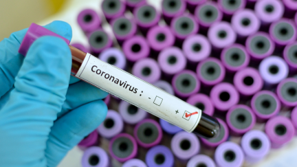 Muestra positiva de COVID-19.