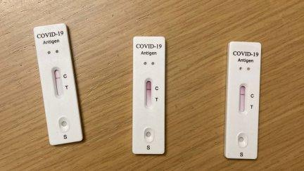 Test de antígenos. / Europa Press