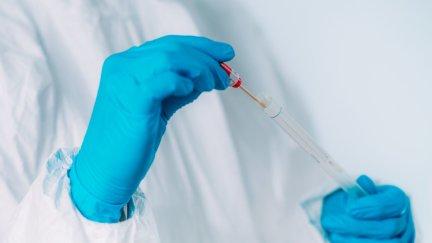 Prueba PCR.
