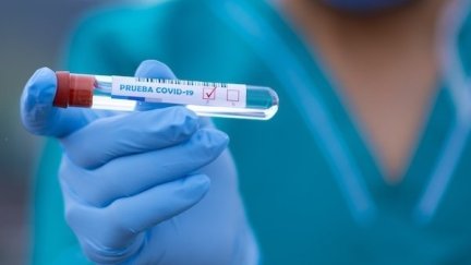 Prueba diagnostica de COVID-19. / Foto: Europa Press