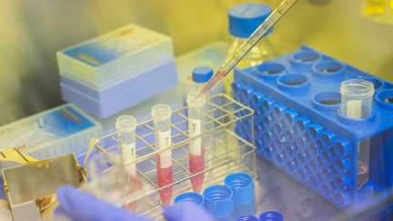 Muestras analizadas en un laboratorio. / Foto: Europa Press