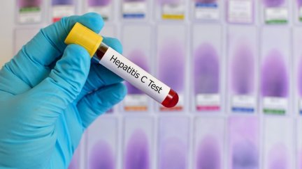 Test para hepatitis C. / Europa Press