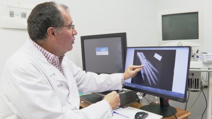 Salvador Baena, del Instituto de Medicina Legal de Aragón, muestra una radiografía de una mano.