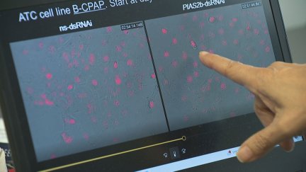 Imágenes de la investigación liderada por la USC.