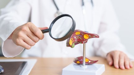 La hepatitis C es la más común en Aragón. / Canva