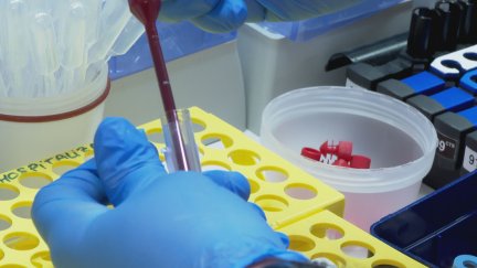 El hospital Clínico aplica la terapia CAR-T. / Aragón TV