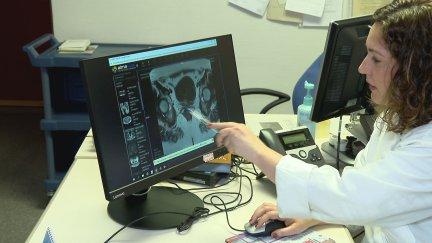 La nueva terapia contra el cáncer de cérvix se aplica con éxito en el Miguel Servet / Aragón Noticias