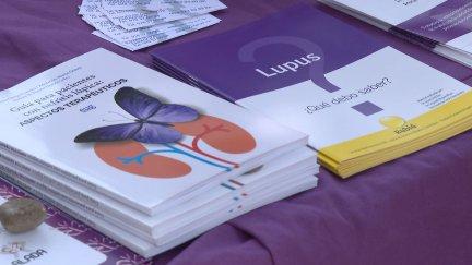 La Asociación de Lupus de Aragón ha estado este fin de semana en el Parque Grande. / Aragón Tv