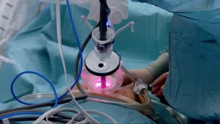 Un paciente se somete a una intervención quirúrgica. / Aragón TV
