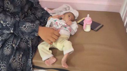 Más de 11.000 niños han ingresado con desnutrición aguda en hospitales de Gaza en menos de dos meses./ Aragón TV