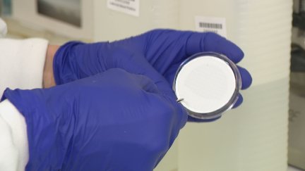 La salmonela produce un cuadro de vómitos, diarreas y fiebre. / Aragón TV