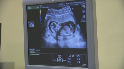 El Gobierno propondrá una reforma de la Constitución para incluir el derecho al aborto en la Carta Magna. / Aragón TV