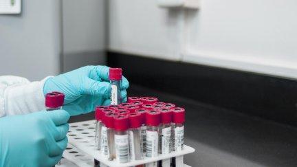 Una vez acordado el pago, indicaban a las mujeres cómo obtener las muestras de sangre por su cuenta. / Pixabay