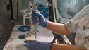 El Hospital Clínico Universitario Lozano Blesa introduce una innovadora prueba que facilita el seguimiento de los pacientes tras un cáncer de vejiga