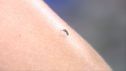 Esta situación favorece la expansión de otras especies invasoras como el mosquito tigre.