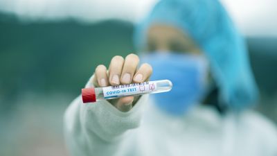 Fotografía coronavirus
