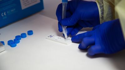 Test de antígenos frente a la COVID-19.