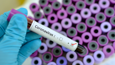 Prueba diagnóstica de COVID-19.