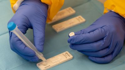 Test de antígenos para la detección de la COVID-19 (EP).