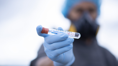 Un sanitario sujeta una prueba diagnóstica de COVID-19.