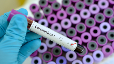 Una muestra positiva de COVID-19.
