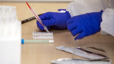 Test de antígenos para la detección de la COVID-19 (EP).