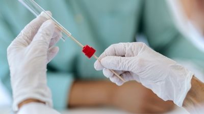 Test para la detección de la COVID-19. / Europa Press