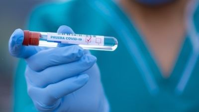 Prueba diagnostica de COVID-19. / Foto: Europa Press