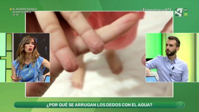 Dedos arrugados y evolución