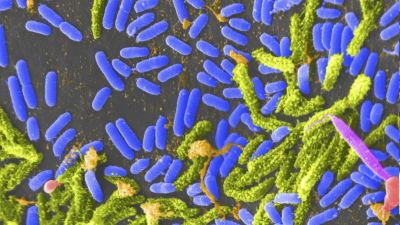 Bacteria Vibrio (azul) que puede causar cólera en humanos. / Europa Press