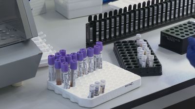 2.500 aragoneses se benefician de los análisis genéticos para prevenir enfermedades