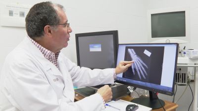 Salvador Baena, del Instituto de Medicina Legal de Aragón, muestra una radiografía de una mano.