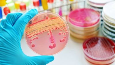 La microbiología necesita tener mayor presencia en la educación de los MIR