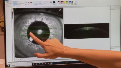 El proyecto quiere buscar en las imágenes existentes datos que permitan prevenir y detectar las enfermedades oculares. / Aragón TV