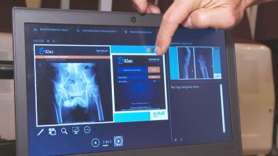 Imagen creada con IA sobre una radiografía. / Aragón TV